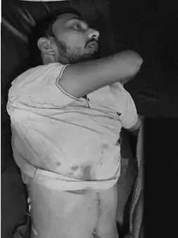 सरयू एक्सप्रेस की दर्दनाक रात: महिला आरक्षी के ब्लेड से गाल काटे, खिड़की पर सिर मारा, जबरदस्ती में कपड़े फाड़े