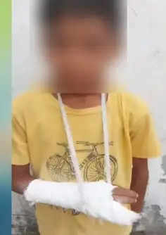 मुजफ्फरनगर जैसा कांड: आरोप लगाया- शिक्षिका ने डंडा मारकर कक्षा तीन के छात्र का तोड़ा हाथ
